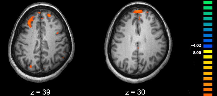 Working Memory