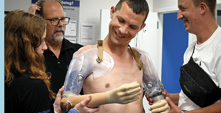 person using a prosthetics arm