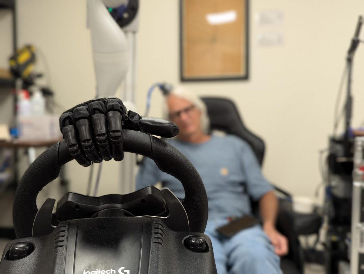 bionic hand on steering wheel