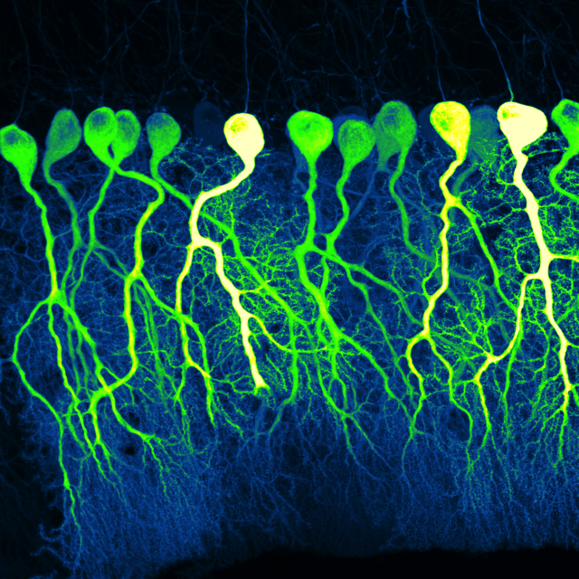 Purkinje cells