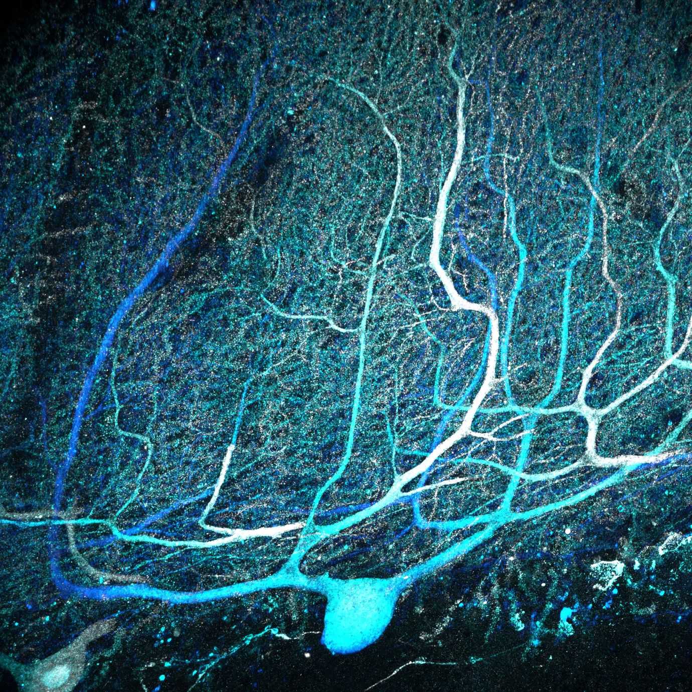 Human purkinje cells