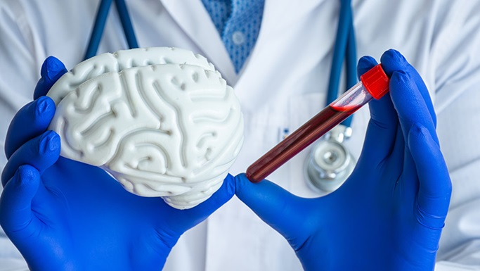 Blood vial and brain 