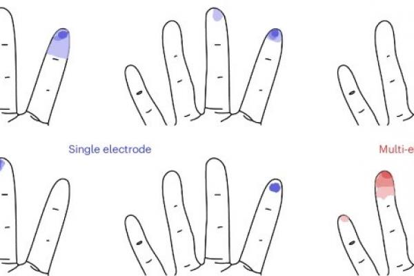 Combining projected fields from individual electrodes