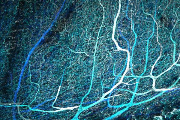 Human purkinje cells