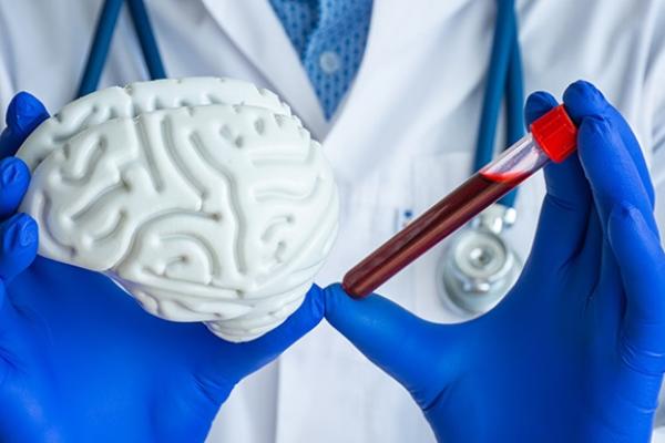 Blood vial and brain