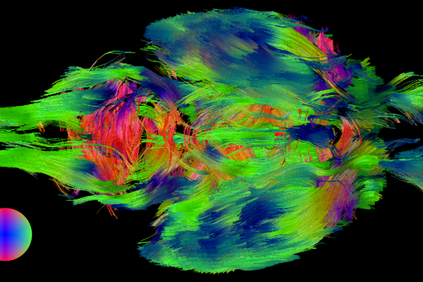  a visualization of whole brain interconnectivity, with colors depicting directionality