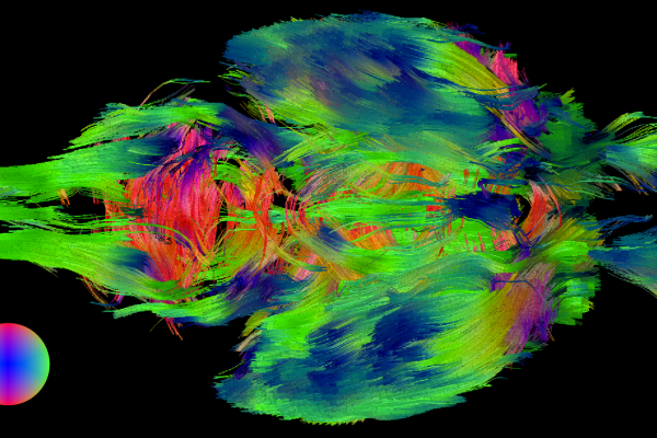 a visualization of whole brain interconnectivity, with colors depicting directionality